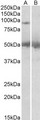 USP6 / HRP1 Antibody - Goat Anti-USP6 / TRE2 / TRE17 Antibody (2µg/ml) staining of Human Placenta lysate (35µg protein in RIPA buffer) with (B) and without (A) blocking with the immunizing peptide. Primary incubation was 1 hour. Detected by chemiluminescencence.
