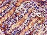 USP6NL Antibody - Immunohistochemistry of paraffin-embedded human small intestine tissue at dilution of 1:100