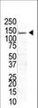 USP8 / UBPY Antibody - The anti-USP8 antibody is used in Western blot to detect USP8 in transfected 293T cells. Data is kindly provided by Lily Yen from University of California Davis (Davis, CA).