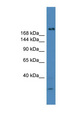 USP9Y Antibody - USP9Y antibody Western blot of Fetal Muscle lysate. This image was taken for the unconjugated form of this product. Other forms have not been tested.