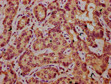 UST Antibody - Immunohistochemistry Dilution at 1:200 and staining in paraffin-embedded human liver cancer performed on a Leica BondTM system. After dewaxing and hydration, antigen retrieval was mediated by high pressure in a citrate buffer (pH 6.0). Section was blocked with 10% normal Goat serum 30min at RT. Then primary antibody (1% BSA) was incubated at 4°C overnight. The primary is detected by a biotinylated Secondary antibody and visualized using an HRP conjugated SP system.