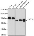 UTP18 Antibody - Western blot analysis of extracts of various cell lines, using UTP18 antibody at 1:1000 dilution. The secondary antibody used was an HRP Goat Anti-Rabbit IgG (H+L) at 1:10000 dilution. Lysates were loaded 25ug per lane and 3% nonfat dry milk in TBST was used for blocking. An ECL Kit was used for detection and the exposure time was 30s.