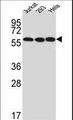 UTP6 Antibody - Western blot of UTP6 Antibody in Jurkat,293,HeLa cell line lysates (35 ug/lane). UTP6 (arrow) was detected using the purified antibody.