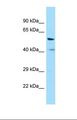 V1RL1 / VN1R1 Antibody - Western blot of Human COLO205. VN1R1 antibody dilution 1.0 ug/ml.  This image was taken for the unconjugated form of this product. Other forms have not been tested.