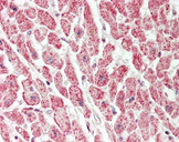 VAC14 / TRX Antibody - Human Heart: Formalin-Fixed, Paraffin-Embedded (FFPE).  This image was taken for the unconjugated form of this product. Other forms have not been tested.