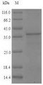 Smallpox-B5R Protein - (Tris-Glycine gel) Discontinuous SDS-PAGE (reduced) with 5% enrichment gel and 15% separation gel.