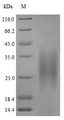 Smallpox-B5R Protein - (Tris-Glycine gel) Discontinuous SDS-PAGE (reduced) with 5% enrichment gel and 15% separation gel.