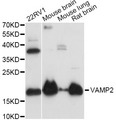 VAMP2 / VAMP-2 Antibody - Western blot analysis of extracts of various cell lines, using VAMP2 antibody at 1:3000 dilution. The secondary antibody used was an HRP Goat Anti-Rabbit IgG (H+L) at 1:10000 dilution. Lysates were loaded 25ug per lane and 3% nonfat dry milk in TBST was used for blocking. An ECL Kit was used for detection and the exposure time was 10s.