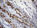 VAMP5 / VAMP-5 Antibody - Immunohistochemical staining of paraffin-embedded Human gastric tissue within the normal limits using anti-VAMP5 mouse monoclonal antibody. (Heat-induced epitope retrieval by 1mM EDTA in 10mM Tris buffer. (pH8.5) at 120°C for 3 min. (1:500)
