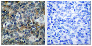 VASP Antibody - Immunohistochemistry analysis of paraffin-embedded human tonsil, using VASP (Phospho-Ser238) Antibody. The picture on the right is blocked with the phospho peptide.