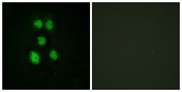 VAV1 / VAV Antibody - Immunofluorescence analysis of HeLa cells, using VAV1 Antibody. The picture on the right is blocked with the synthesized peptide.