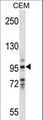 VAV1 / VAV Antibody - VAV1 Antibody western blot of CEM cell line lysates (35 ug/lane). The VAV1 antibody detected the VAV1 protein (arrow).