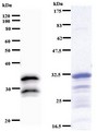 VAX2 Antibody - Western blot of immunized recombinant protein using VAX2 antibody. Left: VAX2 staining. Right: Coomassie Blue staining of immunized recombinant protein.