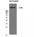 VCAN / Versican Antibody - Western blot of Versican antibody