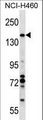 VCPIP1 Antibody - VCIP1 Antibody western blot of NCI-H460 cell line lysates (35 ug/lane). The VCIP1 antibody detected the VCIP1 protein (arrow).