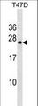 VCX3A Antibody - VCX3A Antibody western blot of T47D cell line lysates (35 ug/lane). The VCX3A antibody detected the VCX3A protein (arrow).