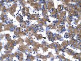 VDAC1 / PORIN Antibody - VDAC1 antibody ARP35122_T100-NP_003365-VDAC1 (voltage-dependent anion channel 1) Antibody was used in IHC to stain formalin-fixed, paraffin-embedded human liver.  This image was taken for the unconjugated form of this product. Other forms have not been tested.