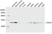 VDAC1 / PORIN Antibody - Western blot of cell and tissue lysates using 1 ug/ml Rabbit Anti-VDAC1 Polyclonal Antibody. The signal was developed with IRDye 800 Conjugated Goat Anti-Rabbit IgG. Predicted Size: 31 KD. Observed Size: 31 KD.