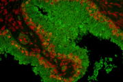 Prostate: Prostate Specific Antigen (rp), fluorescein labeled using the ProtOn Fluorescein Labeling Kit. Propidium Iodide counterstain (red). Mounted in VECTASHIELD® HardSet Mounting Medium.