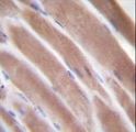 VEGFC Antibody - VEGF3 Antibody immunohistochemistry of formalin-fixed and paraffin-embedded human skeletal muscle followed by peroxidase-conjugated secondary antibody and DAB staining.