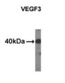 VEGFC Antibody - Western of extracts from HDMEC cells using VEGF3 antibody.