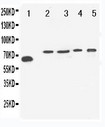 VGF Antibody - WB of VGF antibody. Lane 1: Rat Brain Tissue. Lane 2: U87 Cell Lysate. Lane 3: U87 Cell Lysate. Lane 4: SHG Cell Lysate. Lane 5: NEURO Cell Lysate.