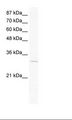 VGLL1 Antibody - Jurkat Cell Lysate.  This image was taken for the unconjugated form of this product. Other forms have not been tested.