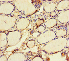 VGLL4 Antibody - Immunohistochemistry of paraffin-embedded human thyroid tissue at dilution of 1:100