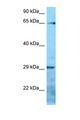 Villin-Like / VILL Antibody - VILL antibody Western blot of 8226 Cell lysate. Antibody concentration 1 ug/ml.  This image was taken for the unconjugated form of this product. Other forms have not been tested.