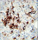 Vimentin Antibody - Vimentin Antibody immunohistochemistry of formalin-fixed and paraffin-embedded human prostate tissue followed by peroxidase-conjugated secondary antibody and DAB staining.