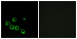 VIPR1 Antibody - Immunofluorescence of MCF7 cells, using VIPR1 Antibody. The picture on the right is treated with the synthesized peptide.