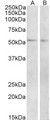 VIPR1 Antibody - Goat Anti-Vipr1 (mouse) Antibody (2µg/ml) staining of Mouse (A) and Rat (B) Small Intestine lysate (35µg protein in RIPA buffer). Primary incubation was 1 hour. Detected by chemiluminescencence.