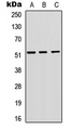 VIPR1 Antibody - Western blot analysis of VIPR1 expression in A549 (A); H9C2 (B); Raw264.7 (C) whole cell lysates.