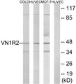 VN1R2 Antibody - Western blot analysis of lysates from HUVEC, COLO, and MCF-7 cells, using VN1R2 Antibody. The lane on the right is blocked with the synthesized peptide.