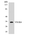 VN1R4 Antibody - Western blot analysis of the lysates from COLO205 cells using VN1R4 antibody.