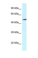VNN2 Antibody - VNN2 antibody Western blot of Fetal Kidney lysate. Antibody concentration 1 ug/ml.  This image was taken for the unconjugated form of this product. Other forms have not been tested.