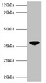 VP3 / Apoptin Antibody - Western blot All lanes: Chicken anemia virus apoptin antibody at 2µg/ml + GST-Apoptin fusion protein at 0.4µg Secondary Goat polyclonal to rabbit IgG at 1/10000 dilution Predicted band size: 40 kDa Observed band size: 40 kDa