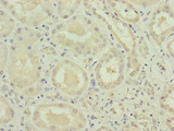 VPS11 Antibody - Immunohistochemistry of paraffin-embedded human kidney tissue at dilution of 1:100