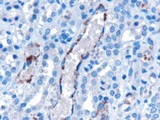 VPS25 Antibody - Goat Anti-VPS25 Antibody (10µg/ml) staining of paraffin embedded human kidney. Microwaved antigen retrieval with Tris/EDTA buffer pH9, HRP-staining. This data is from a previous batch, not on sale.