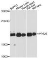 VPS25 Antibody - Western blot analysis of extracts of various cell lines, using VPS25 antibody at 1:3000 dilution. The secondary antibody used was an HRP Goat Anti-Rabbit IgG (H+L) at 1:10000 dilution. Lysates were loaded 25ug per lane and 3% nonfat dry milk in TBST was used for blocking. An ECL Kit was used for detection and the exposure time was 30s.