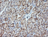 VPS28 Antibody - IHC of paraffin-embedded Human pancreas tissue using anti-VPS28 mouse monoclonal antibody. (Heat-induced epitope retrieval by 10mM citric buffer, pH6.0, 120°C for 3min).