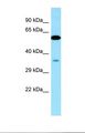 VPS33A Antibody - Western blot of Human 721_B . VPS33A antibody dilution 1.0 ug/ml.  This image was taken for the unconjugated form of this product. Other forms have not been tested.