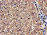 VPS39 Antibody - Immunohistochemistry of paraffin-embedded human liver tissue at dilution of 1:100