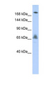 VPS8 Antibody - VPS8 antibody Western blot of HepG2 cell lysate. This image was taken for the unconjugated form of this product. Other forms have not been tested.