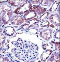 VR1 / TRPV1 Antibody - TRPV1 Antibody immunohistochemistry of formalin-fixed and paraffin-embedded human kidney tissue followed by peroxidase-conjugated secondary antibody and DAB staining.