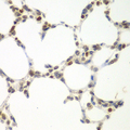 VRK1 Antibody - Immunohistochemistry of paraffin-embedded mouse lung tissue.