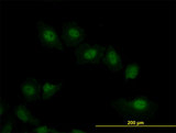 VRK2 Antibody - Immunofluorescence of monoclonal antibody to VRK2 on HeLa cell. [antibody concentration 10 ug/ml]