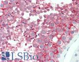 VSIG1 Antibody - Human Testis: Formalin-Fixed, Paraffin-Embedded (FFPE)