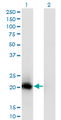 VSTM2L Antibody - Western blot of VSTM2L expression in transfected 293T cell line by C20orf102 monoclonal antibody (M02), clone 1A8.