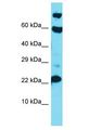 VSTM5 Antibody - VSTM5 antibody Western Blot of A549. Antibody dilution: 1 ug/ml.  This image was taken for the unconjugated form of this product. Other forms have not been tested.